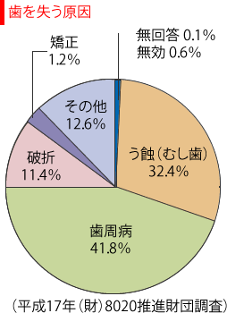 永久歯の抜歯原因調査