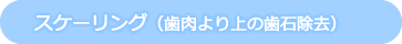 スケーリング(歯肉より上の歯石除去)