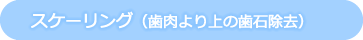 スケーリング（歯肉より上の歯石除去）