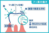 再石灰化